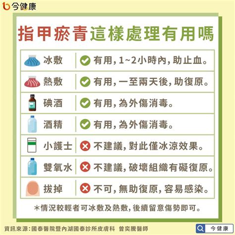 腳指甲受傷|指甲瘀青要冰敷、拔掉嗎？醫師揭正確處理方法，出現…